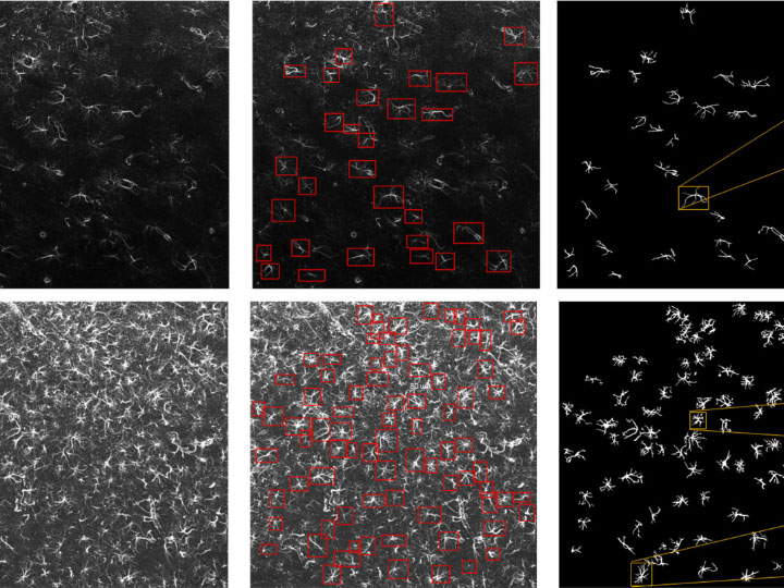 A figure from the paper displays the process of machine learning detecting astrocytes and then individually segmenting the cells.